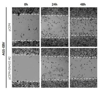 SNHG5의 발현이 AGS-EBV의 이동성에 미치는 영향 관찰