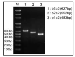 BCR-ABL 융합유전자의 세 가지 이어맞춤변이체에 따른 PCR product 확인