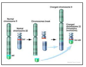 염색체 전좌에 의한 백혈병 유발 Bcr-Abl 융합유전자 생성