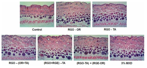 Effects of red ginseng oil and red ginseng extract on hair follicles growth. The effects of RGO, RGE and or MXD on the hair follicles of the mice were analyzed by using hematoxylin and eosin staining