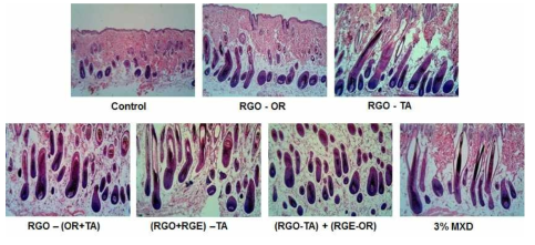 Effects of red ginseng oil and red ginseng extract on hair follicles growth. The effects of RGO, RGE and or MXD on the hair follicles of the mice were analyzed by using hematoxylin and eosin staining. Longitudinal sections of the back skin were stained and representative photomicrographs of skins sections are shown. (RGO: red ginseng oil; RGE: red ginseng extract; MXD: minoxidil; OR: oral gavage; TA: topical application)