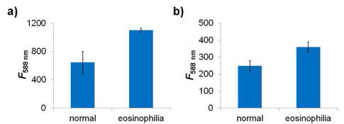 프로브 (a)2와 (b)1-Zn를 이용해서 human serum(42:98:60 lysate:buffer:EtOH, v/v, ×1 SSC buffer, pH = 7.4)에서 eosinophilia와 일반 혈액을 구분한 것