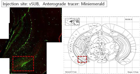 Anterograde transport 분자인 miniemerald의 주입 부위