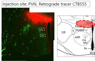 Retrograde transport 분자인 CTB555의 주입 부위