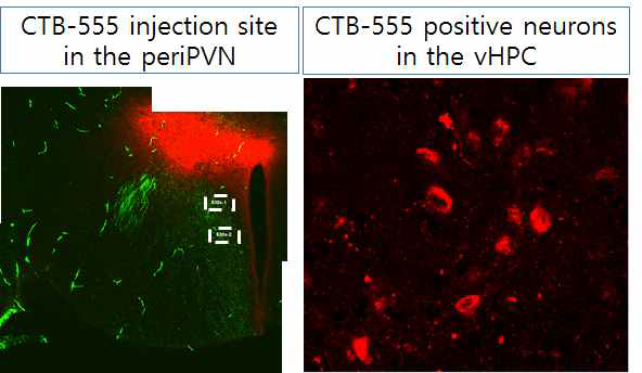 vSubiculum 신경세포의 periPVN으로 연접