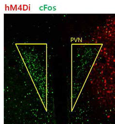 periPVN GABAergic 신경세포의 활성 조절에 의한 PVN 신경세포의 활성변화