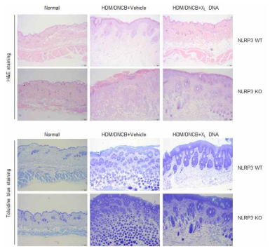 NLRP3 넉아웃 마우스에서 DNCB/HDM 유도 아토피 피부염 유발 후 피부조직 변화 및 X-DNA의 영향