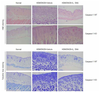 Caspase-1 넉아웃 마우스에서 DNCB/HDM 유도 아토피 피부염 유발 후의 피부조직 변화 및 X-DNA의 영향