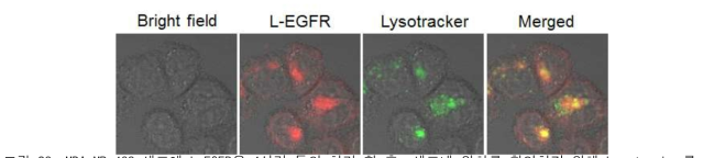 MDA-MB-468 세포에 L-EGFR을 4시간 동안 처리 한 후, 세포내 위치를 확인하기 위해 Lysotracker를