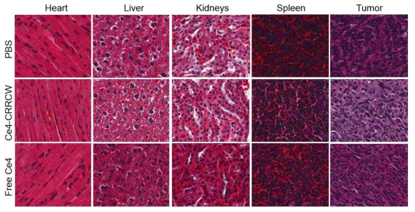 약물을 투여한지 24시간이 지난 후, 각 기관의 H&E 염색 사진. Ce4-CRRCW와 free Ce4가 종양 외의