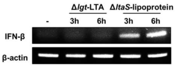 지질단백질 또는 LTA에 의한 IFN-β mRNA 발현양상 비교 분석