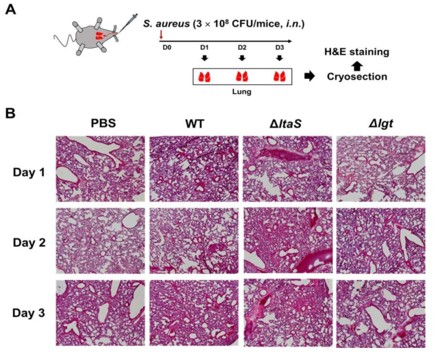 황색포도상구균의 생체 내 감염에 의한 면역세포 유입에서 지질단백질과 LTA의 역할 규명 연구 (A) 황색포도상구균에 의한 폐 조직내 면역세포 유입 양상 확인을 위한 실험과정, (B) 야생형, LTA 결손균주, 지질단백질 결손균주 감염에 의한 마우스 폐 조직내 면역세포 유입 양상 비교