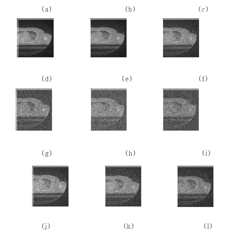 CT 복원 영상 (Poisson noise power, Gaussian standard deviation) (a) 필터 비처리 영상 (1, 0.001), (b) 필터 비처리 영상 (1, 0.0025), (c) 필터 비처리 영상 (3, 0.01), (d) 필터 처리 영상 (1, 0.001), (e) 필터 처리 영상 (1, 0.0025), (f) 필터 처리 영상 (3, 0.01), (g) 필터 비처리 영상 (3, 0.025), (h) 필터 비처리 영상 (5, 0.001), (i) 필터 비처리 영상 (3, 0.0025), (j) 필터 처리 영상 (3, 0.025), (k) 필터 처리 영상 (5, 0.01), (l) 필터 처리 영상 (5, 0.025)