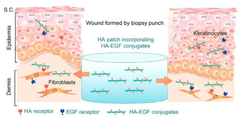 Schematic representation for topical application of HA gel patch on skin tissues of wound model