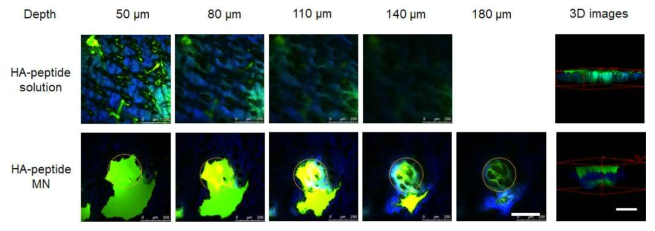 Two-photon microscopic images of cross-sections of skin at determined depth (left) and 3-dimensional images produced by stacking cross-sectional images 1 h after transdermal delivery of FITC-labeled hyaluronate-peptide conjugate (HA-peptide) solution and microneedle incorporating the solution. Scale bars are 250 ㎛ in cross-sectional images and 200 ㎛ in 3D images. Blue signal is derived from collagen layer of dermis