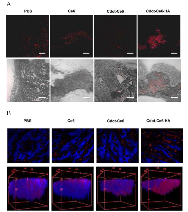 (A) Confocal (top) and merged (bottom) images of cryo-sectioned cancerous mouse skin tissues after topical treatment with PBS, Ce6, Cdot-Ce6, and Cdot-Ce6-HA conjugates (scale bars = 200 μm). Red fluorescence corresponds to Ce6. (B) Two-photon microscopic cross-sectional views at the Z-stack of 60 μm and 3D two-photon fluorescence images of excised tumors without skin tissues after topical treatment with PBS, Ce6, Cdot-Ce6, and Cdot-Ce6-HA conjugates (blue: collagen, red: Ce6)