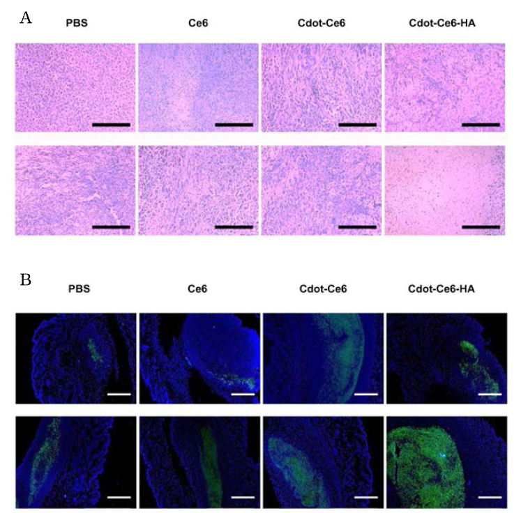 (A) Histological analysis of cancerous skin tissues with H&E staining after treatment with PBS, Ce6, Cdot-Ce6, or Cdot-Ce6-HA conjugate in the absence (top) and presence (bottom) of laser irradiation (black scale bar = 200 μm). (B) TUNEL assays of cancerous skin tissues after treatment with PBS, Ce6, Cdot-Ce6, and Cdot-Ce6-HA conjugate in the absence (top) and presence (bottom) of laser irradiation