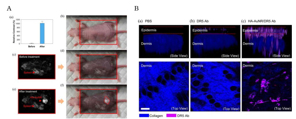 (A) Photoacoustic (PA) microscopy for transdermal delivery of HA-AuNR through mouse back skin at 800 nm wavelength. (B) Two-photon microscopic images of back skin in mice after treatment