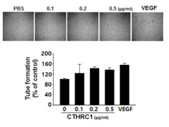 CTHRC1 단백질에 의한 혈관내피세포의 형태적 분화에 대한 효과