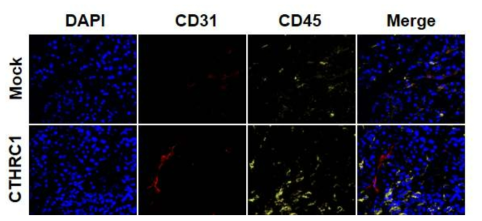 CTHRC1의 혈관형성능에 대한 in vivo assay를 통한 확인