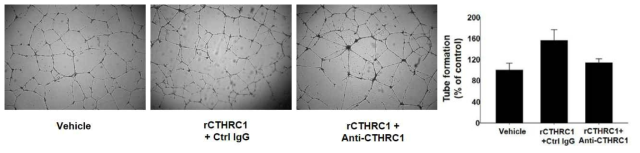 CTHRC1 특이 중화항체에 의한 혈관내피세포의 형태적 분화 억제능에 대한 효과