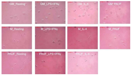 M1, M2 대식세포와 PAUF-treated 대식세포의 morphology 비교