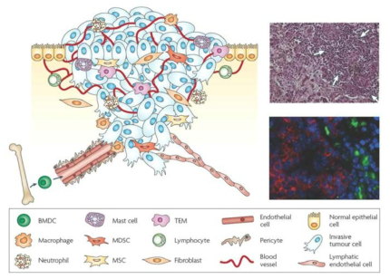 종양세포와 다양한 기질세포가 혼재하는 종양복잡계