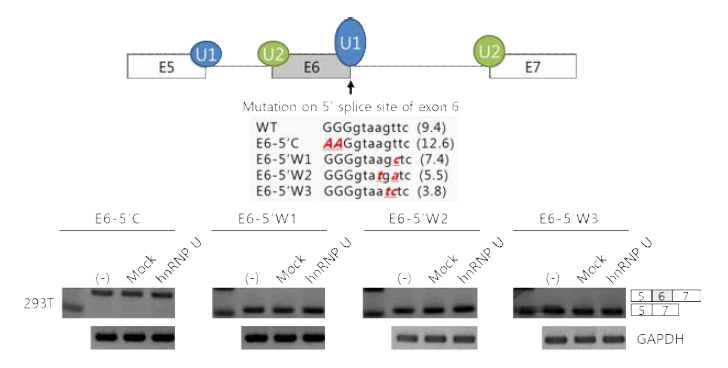 Fas exon 6의 5`splice site mutation