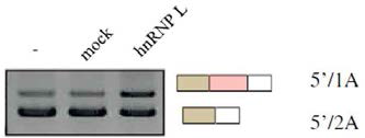 Bcl-x mini-gene과 hnRNP L의 overexpression 실험