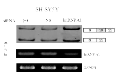 hnRNP A1 knockdown 실험