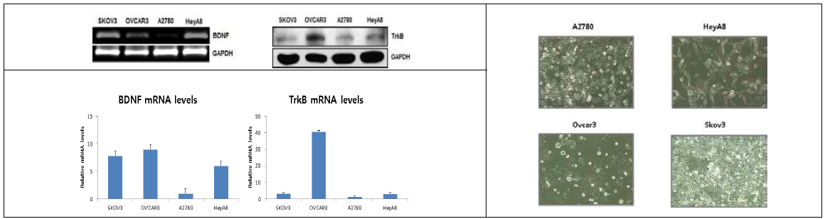 난소암 세포주에서 BDNF, TrkB의 발현을 mRNA와 protein으로 확인함