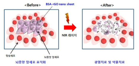 지능형 그래핀 나노소재(BSA-rGO nano sheet)와 NIR 레이저로 암세포 광열치료와 약물치료 기술