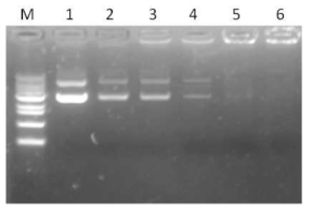 Gel retarding analysis of pRING-CNPs. M: 1 kb Marker, Lane 1: naked DNA; lanes 2–6: