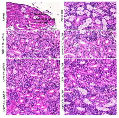 Histology of kidney tissue of zebrafish after IP injection of CNPs, CAgNPs, Al(OH)3 and