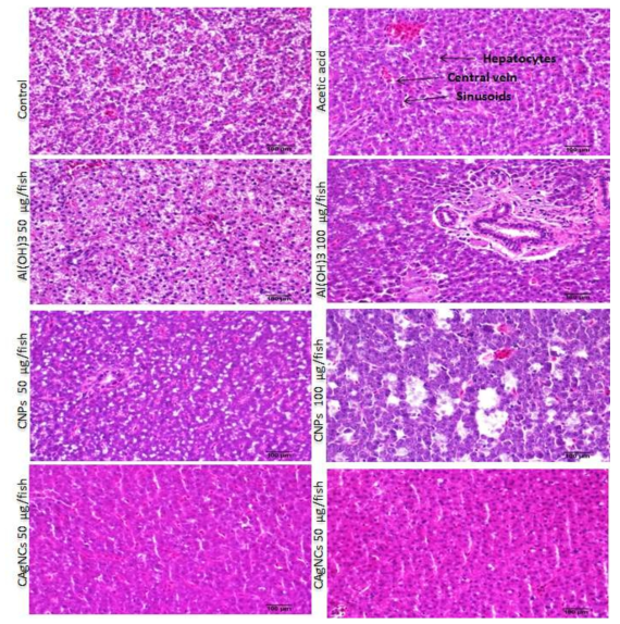Histology of liver tissue of zebrafish after IP injection of CNPs, CAgNPs, Al(OH)3 and acetic