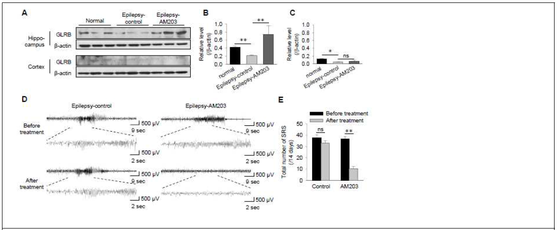 Pilocarpine 뇌전증 모델에서 과발현된 miR-203을 AM-203 투여로 조절함. 투여 결과, target 단백질인 GLRB의 발현이 증가되면서 뇌전증의 발생 빈도가 줄어듬이 확인됨