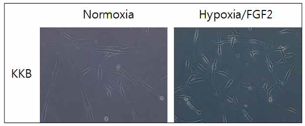 hPDLSC의 배양 조건에 따른 세포 형태의 변화 Hypoxia/FGF2처치 조건에서 보다 성장 속도가 빠름
