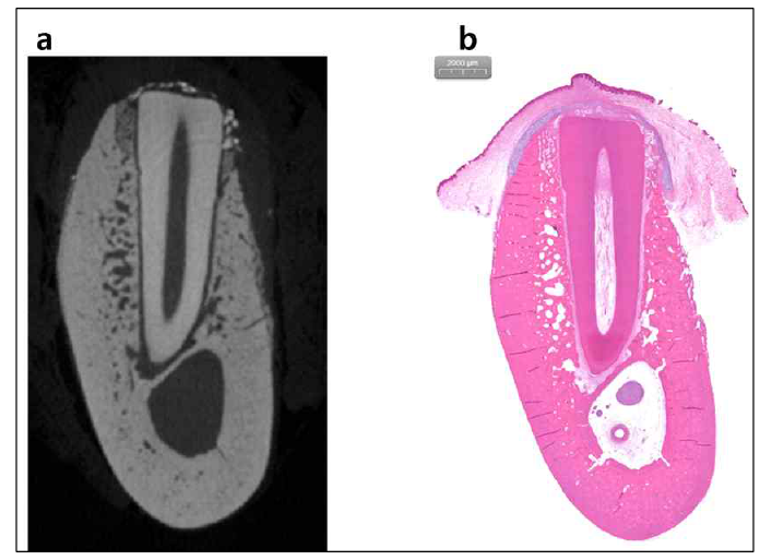 치주 인대의 세포 성분의 치조골 유지 및 재생에 미치는 효과를 보여주는 결과. a : uCT 분석 결과, b : 조직학적 분석 결과