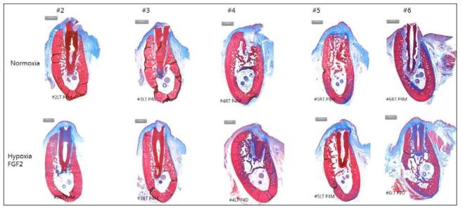 Masson Trichrome 염색에 의한 조직학적 분석결과 : collagenous PDL like tissue가 조직학적 평가를 용이하게 함