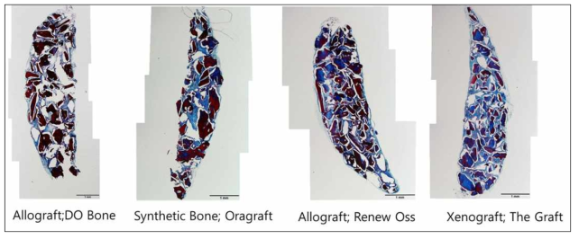 control group의 cell attachment pattern : allograft, synthetic Bone graft 및 xenograft를 단독으로 ectopic transplantation model에 이식하였을 때 모든 재료에서 cell attachment는 형성되지 못하였음