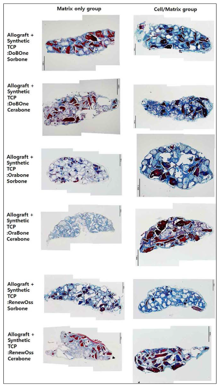 Allograft 각 Tissue matrix와 TCP의 혼합물과 ABMSC의 이식 결과에 대한 조직학적 분석