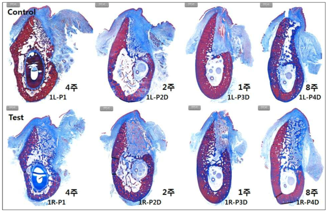masson trichrome 염색에서 파괴된 발치와의 치유 과정을 보다 자세히 관찰할 수 있음. control에서 new bony projection을 보다 명확히 볼 수 있으며 4주에 재생 부위가 명확히 경계 지을 수 있음을 알 수 있었음. Test군에서 다소 치유가 느린 것을 볼 수 있음. 하지만 new bony projection의 형성 범위가 control에 비교하여 유의하게 증가되어 있고 8주에서도 계속 활발한 골재생 양상을 볼 수 있음
