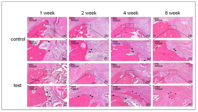 치조골 상방 crest부위에서 치조골 형성의 차이점. control군에서 발치와 상방(coronal부위)에서 osteoclast의 출현을 확인할 수 있었음. 8주에 치조골 crest전반 적인 부위에 걸쳐 osteoclast가 출현됨. 이는 치조골 부피 수축의 세포학적 기전을 제시하는 것임. 반면, 골이식재가 이식된 test군에서는 비록 osteoclast가 관찰되지만 control군에 비하여 유이하게 적은 수가 관찰되며, 흥미로운 것은 4주 그리고 8주에서도 신생골 형성 양상을 볼 수 있었음. 이는 이식된 골이식재에 의해서 발치와 치유 반응에 변화가 유도되었다고 결론지을 수 있음