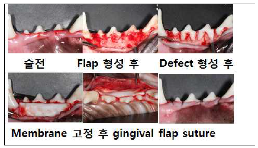 dehiscence type의 치주골 결손을 형성 후 membrane 고정