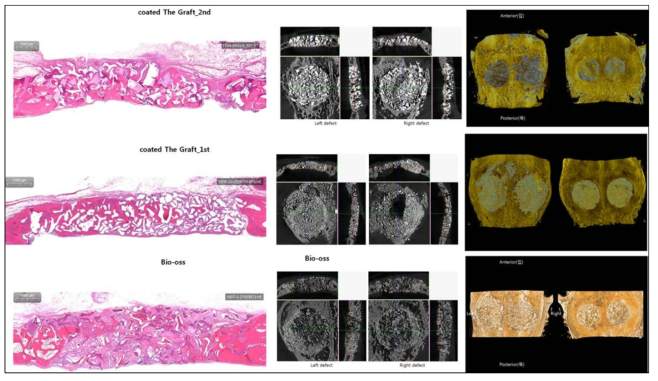 coated The GRAFT의 골재생 평가를 위한 rabbit calvarial defect 실험 결과 : coated The GRAFT 기존 The GRAFT의 골재생 효과와 동등한 결과를 보였는데 이들 결과는 수입품인 Bio-oss의 골재생 효과와 비교하였을 때 유의하게 높은 골재생 효과임