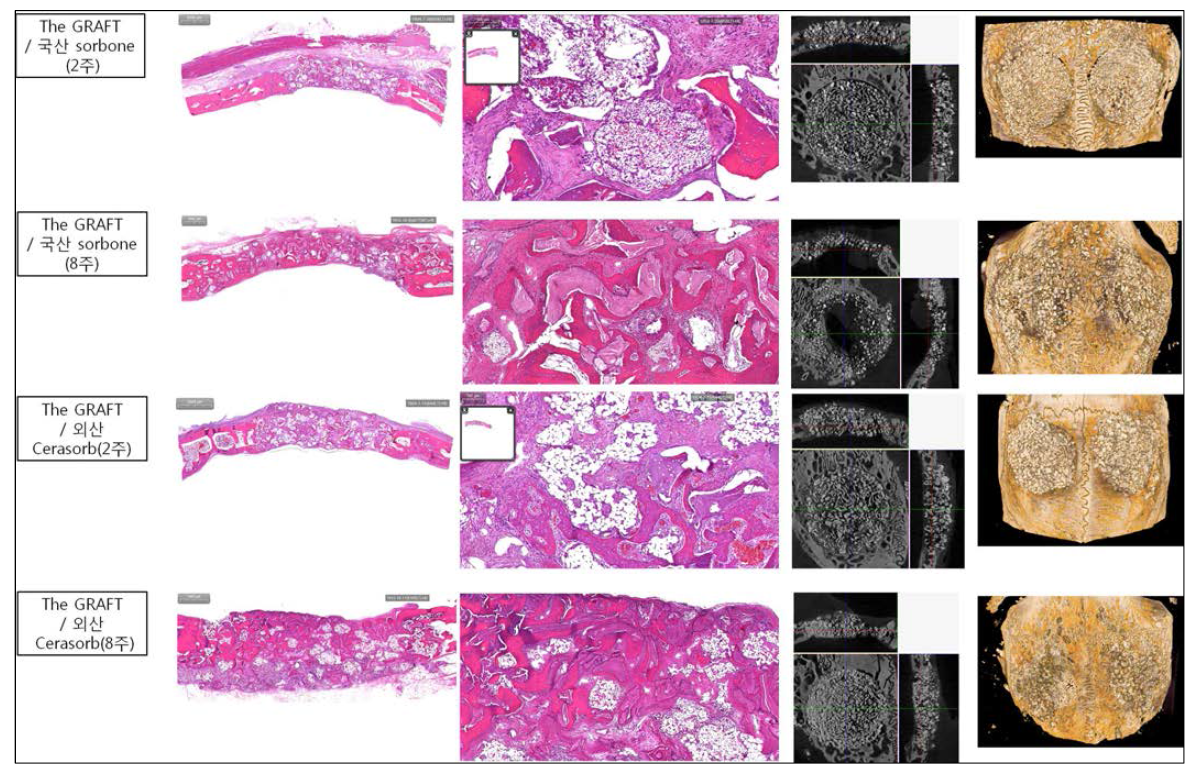 TCP를 혼합하였을 때 The GRAFT 표면으로 유의하게 증가된 신생골 형성 결과를 얻을 수 있음. TCP의 osteoinduction 효과는 Cerabone보다는 국내 개발된 Sorbone에서 보다 유의한 결과를 보임
