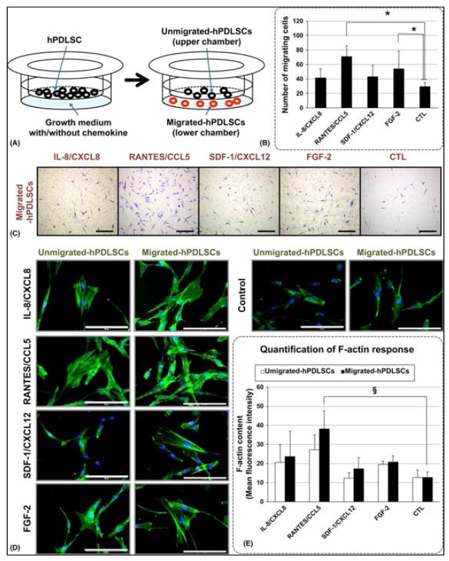 co-culture dish를 이용하여 각 염증성 chemokine에 의해 유도되는 이동성 치주인대줄기세포를 분리하였음. 각 이동된 치주 인대 줄기세포는F actin의 발현양상이 틀렸는데 RANTES에 의한 F actin 자극 효과가 유의하게 증가되었음