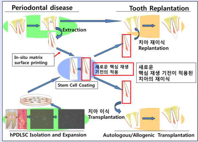 새로운 핵심 재생 기전이 적용된 치아 재이식 기법은 치주 질환의 해결 불가능한 난제를 극복할 해결 방안임