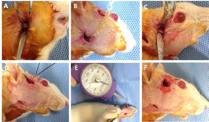 역학적 과부하 모델의 수술 방법. A, 하악각 부위를 절개 후 노출시킴. B, 하악각 부위 골에 작은 구멍을 뚫고 교정용 elastic을 silk를 이용하여 고정함. C, 관골궁을 절개후 노출시킴, 작은 구멍을 뚫음. D, 저작근 하방으로 교정용 elastic을 통과시켜 관골궁 부위와 개통시킴. E, 50g의 하중을 가하여 elastic을 당긴 상태로 관골궁의 구멍에 silk를 이용하여 교정함. F, 고정된 모습