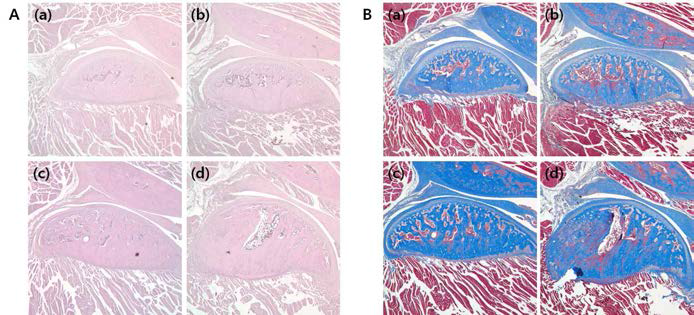 난소절제술 8주, 12주 후 하악과두 변화양상. A, HE staining; B, MT staining. (a), 8-week sham group; (b), 8-week OVX group; (c), 12-week sham group; (d), 12-week OVX group